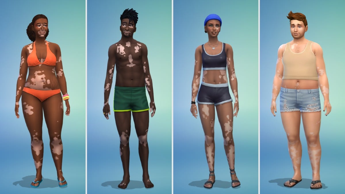 Sims 4 Free Update Vitiligo