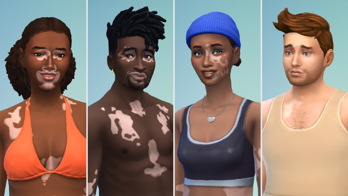 Sims 4 Vitiligo Update February 2024